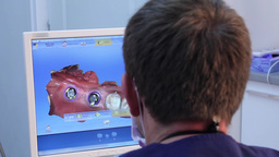 3D dental digital modeling restoration